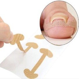 Roycecoqtu 50 Sheets of Ingrown Toenail Protection Band