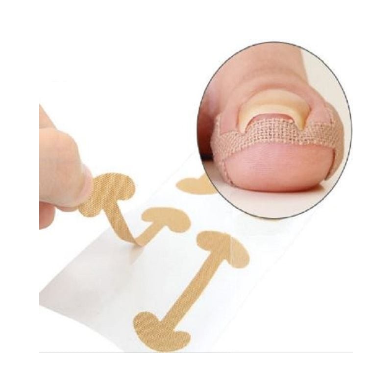 Roycecoqtu 50 Sheets of Ingrown Toenail Protection Band