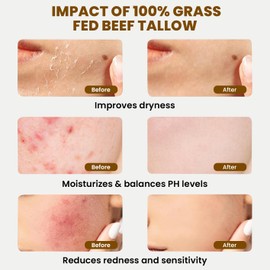 MONIER Whipped Beef Tallow for Skin, Tallow and Honey Balm for Face, Moisturizer with 100% Organic Grass-Fed Beef Tallow & Raw Wild Honey - Packaging May Vary - Dry & Sensitive Skin (Unscented)