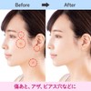 CLASSE Temporary Tattoo Sticker Concealer for Scars, Birthmarks, Self-Harm Marks,