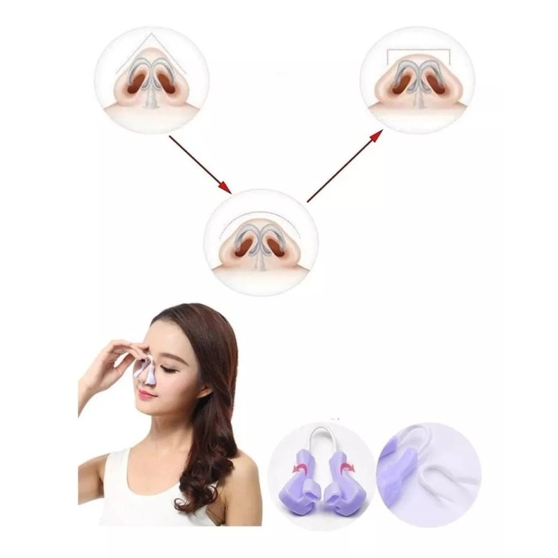 Health Technology Corrector Respingador Nasal Permanente ¡sin Cirugía! Alza