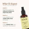 Wonder Growth Spray for Women, 9-in-1 SuperBoost, Natural Hair Loss