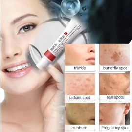 Cara Crema para Manchas Oscuras en La Cara, Cremas Quitar de La...
