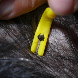 Tick Removers From Animal Hospital Pack of Two (one big one small) The Best Most Effective Tick Removal Tool on The Market, Used For The Safe Removal Of Ticks From Dogs Horses Cats Sheep or Human