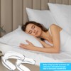 Grinding Splint for Night, Pack of 4 Bite Splints for