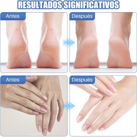 Urea Pies,Crema con Urea para Pies ,Crema para Talones Agrietados ,Crema Hidratante Para Pies, Crema Hidratante Para Pies Con Urea 60, Exfoliante E Hidratante, Elimina Eficazmente Callos Y Piel Gruesa (40 g)