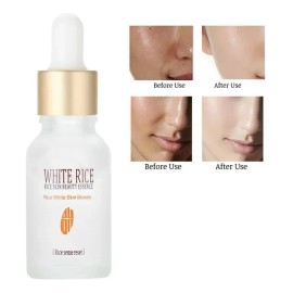 Esencia Facial Arroz Hidratante Aclarante Suavizante Mixta
