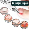 Toe Nail Clippers for Thick Nails,Heavy Duty Professional Nail Clippers
