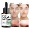 Mopoyat Suero Facial Con Ácido Salicílico 30ml