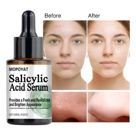 Mopoyat Suero Facial Con Ácido Salicílico 30ml                                                                                                        