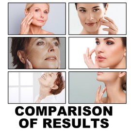 Neck Firming Tightening Cream,Retinol Anti-Aging Neck Cream for Tightening and Wrinkles on Neck,Tighten and Lift Neck Cream,Face Moisturizer for Women,Skin Tightening Cream Body,Anti Wrinkle Cre-am