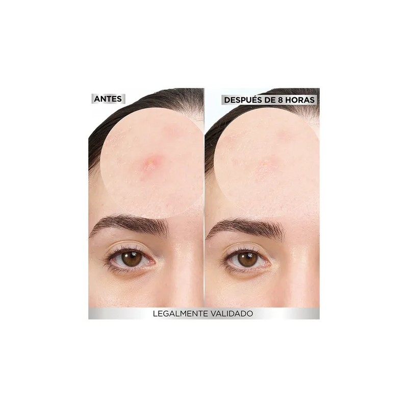 Parches Para Acné Invisibles Pimple Patch 22 unidades Garnier