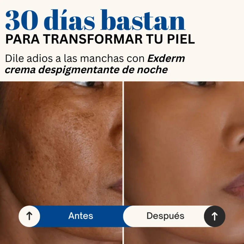 Exderm White Crema Despigmentante Intensiva De Noche 30 Ml Tipo