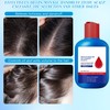 Viuvoiul Nipori Shampoo Anti，Nipori Dandruff Hair Care Shampoo - Oil