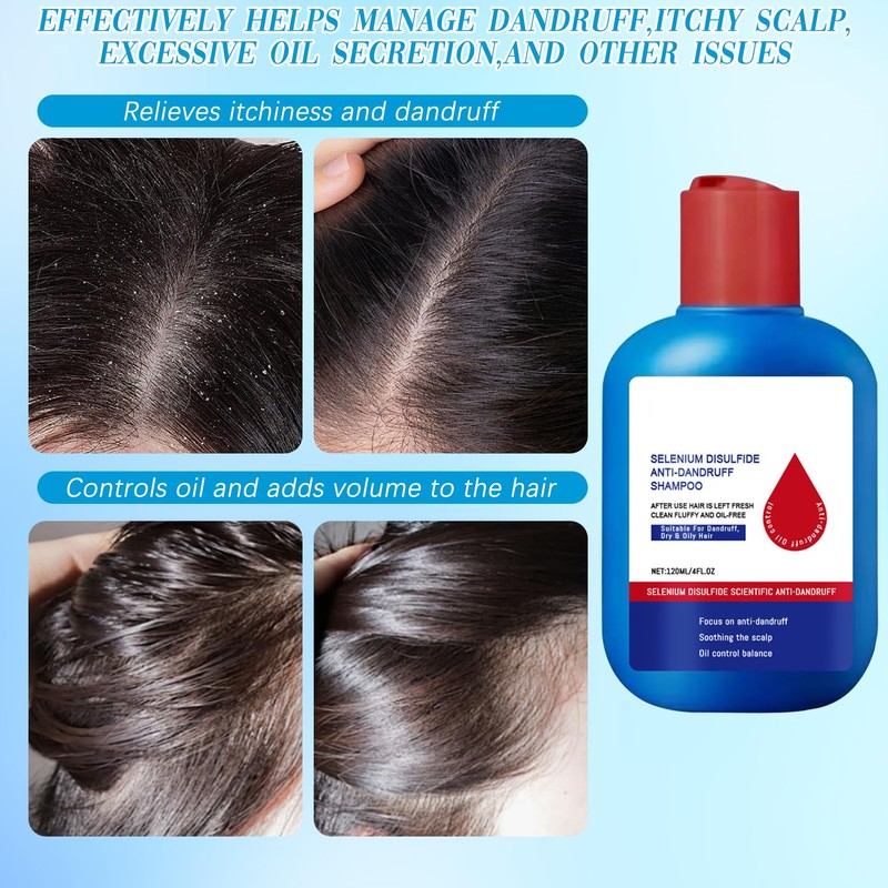 Viuvoiul Nipori Shampoo Anti，Nipori Dandruff Hair Care Shampoo - Oil