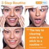 Acnefree 24 Hour Acne Clearing System Kit (Pack of 6)