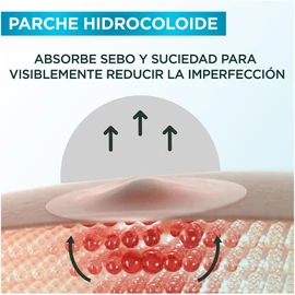 Garnier Pimple Patch Invisible. Parches para acné que reducen la visibilidad de las imperfecciones en 8 horas. Clínicamente Probado [Parche Hidrocoloide], 22 piezas 10mm x 12mm. Cruelty Free, Vegano