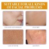 Sérum Facial Con Vitamina C Oceaura, Tamaño De Viaje