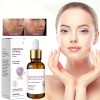 Srum Rejuvenecedor Con Retinol Bakuchiol 30 Ml B