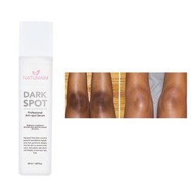 Natuhaim Dark Spot Serum - Anti-Dark Spot Serum for Skin Care, Rejuvenate with Comfort