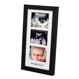trlry Triple Ultrasound Picture Frames, Sonogram Picture Frame 3 Photos,Pregnancy Announcements,Pregnancy Gifts for First Time Moms,First Time Mom Gift,Black,Ultrasound Photo Album