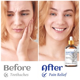 HIQILI 100ML Essential Pure Natural Clove Oil Premium Quality for Tooth, Hair, Skin, Spray, Diffuser, Massage - 3.38 Fl Oz