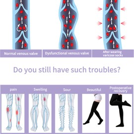 Evolyline Medical Compression Stockings, 20-30 mmHG Support Stockings for Men and Women, Medical Class 2 Thigh Stockings, Prevent Varicose Veins (Beige), black