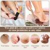 START MAKERS Foot File, 2Pcs Foot Scrubber Callus Remover for