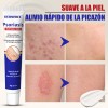 Crema De Tratamiento Psoriasis Para Picazón Y Escamosa