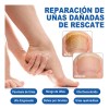 Líquido Antibacteriano De Uñas Grises Uñas Enfermas 30ml