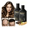 5 Minoxidil Shampoo Crecimiento Con Biotin Y Acondicionador