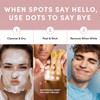 Clear Spot Dots – Invisible Hydrocolloid Pimple Patches – Gentle