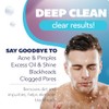 Asepxia Acne Treatment Scrub Cleansing Bar Soap | Removes pore-clogging