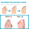 Nolimvita Hammer Toe Straightener Corrector - Toe Spacers Toe Splints