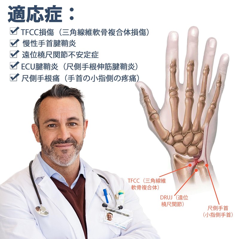 Jomeca tfcc損傷サポーター 小指側保護 リングガスケット内蔵（S/Mサイズ）