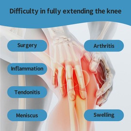 Knee Extension Recovery Device | Essential Aid for Knee Surgery Rehabilitation - Supports Leg Straightening and Flexibility After Knee Replacement(Weights Not Included)