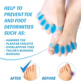 4Pairs Toe Separator, Toe straighteners for Curled Toes, Toe Spacers, Toe separators to Correct Your Toe, Toe Straighteners for Correct Bunions,Manicure,Spacer Running Yoga Pedicure