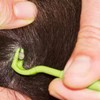 Pet Tick Remover Tool Set, 3 Sizes, Lime Green, for