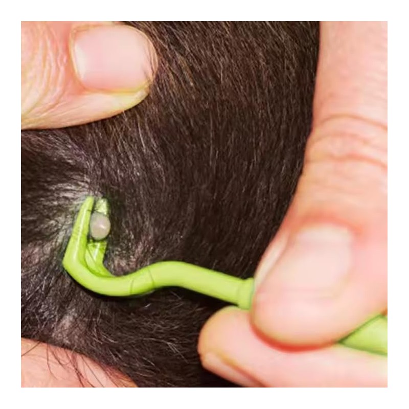 Pet Tick Remover Tool Set, 3 Sizes, Lime Green, for