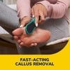 Dr. Scholl's Fast Acting Callus Remover Gel Kit, Hard Skin
