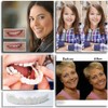 3 Piece Set Instant Dentures, Dentures, Beauty, Cosmetic Teeth, Upper