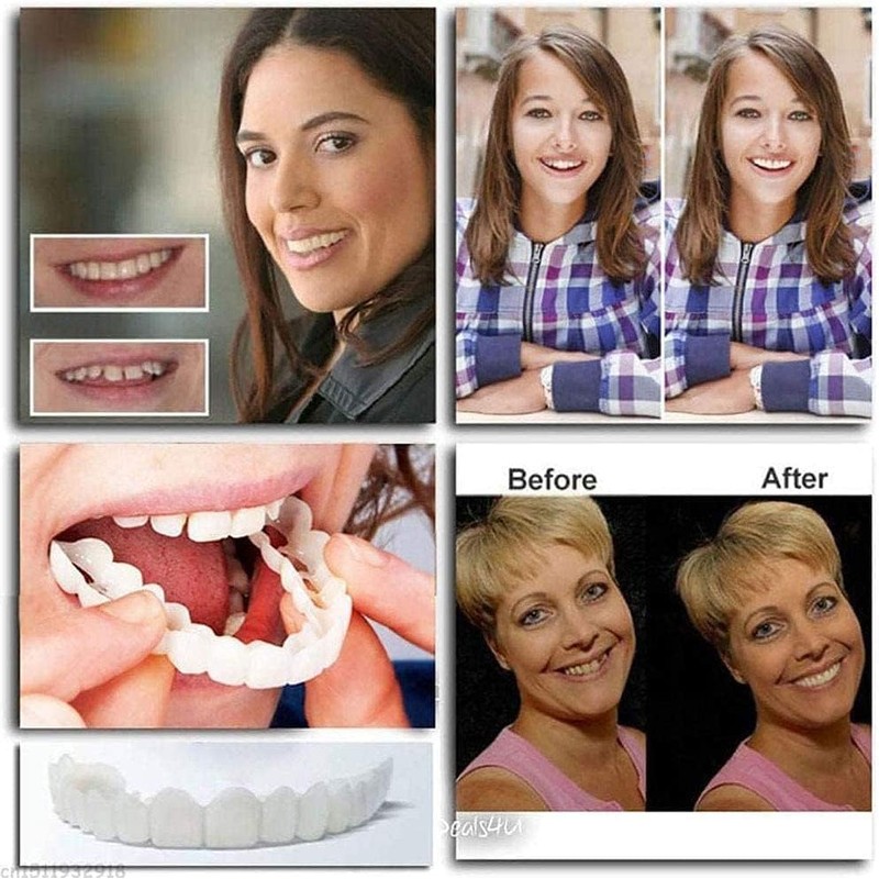 3 Piece Set Instant Dentures, Dentures, Beauty, Cosmetic Teeth, Upper