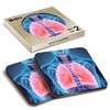 2 x Square Coasters - Human 3D Lungs Doctor Hospital