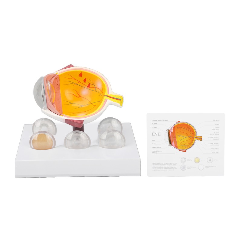 Enlarged Human Eye Anatomical Model Accurate Shows Optic Nerves Cornea