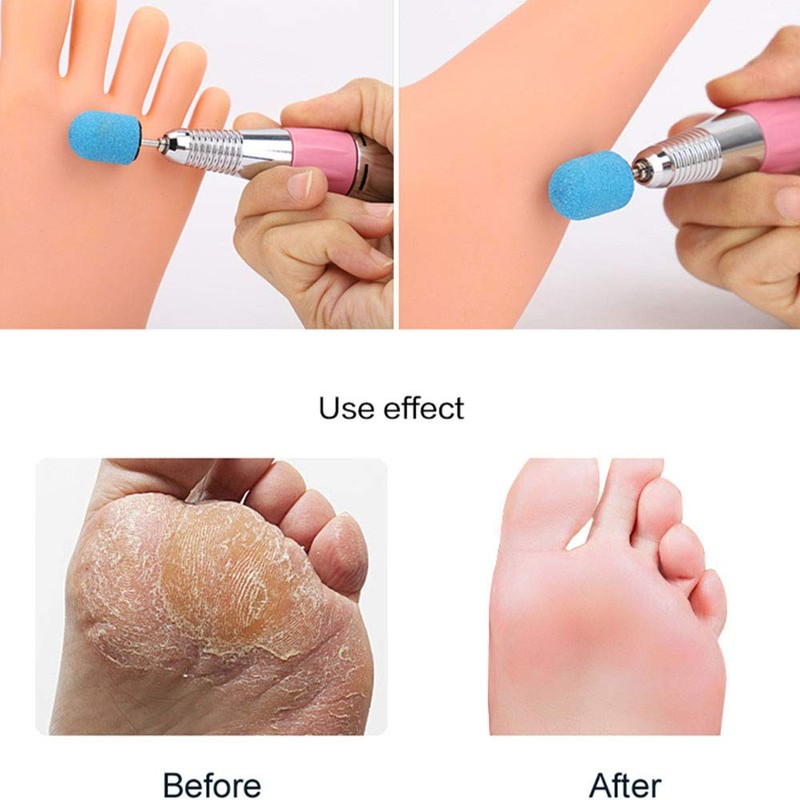 10 x Sanding Caps with 1 x Mandrel Handle Sanding