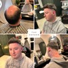 Topunique Toupee for Men with 0.03mm Ultra-Thin Skin Base 8x10