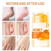 Honey Foot Cream – Moisturizer for Dry Hands & Cracked