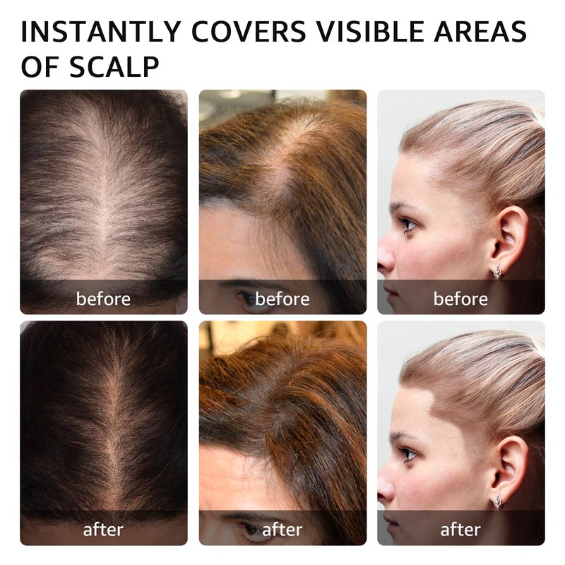 Root Touch Up Gray Hair Shadow Powder for Thinning Hair,