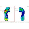 Orthopädische Weichpolstereinlage bei Hallux valgus stützt bei Knick- Senk- Spreizfüßen