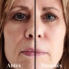 Kit Antiedad Y Rejuvenecedor Lilo Skincare Vitamina E